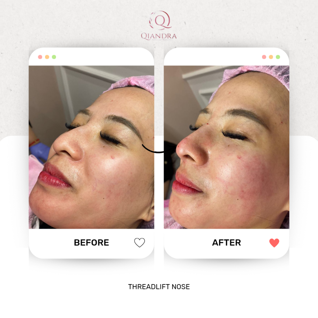 klinik kecantikan qiandra