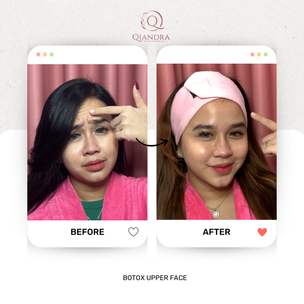 klinik kecantikan qiandra