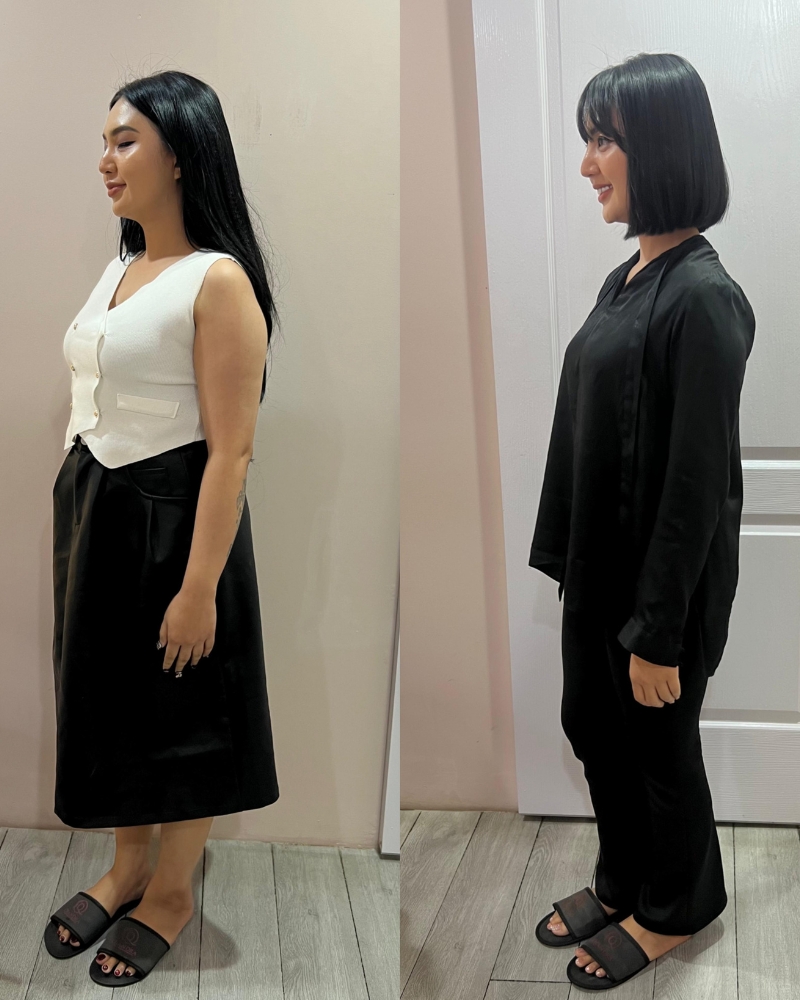 Before after Weight Loss Programme Qiandra Clinic